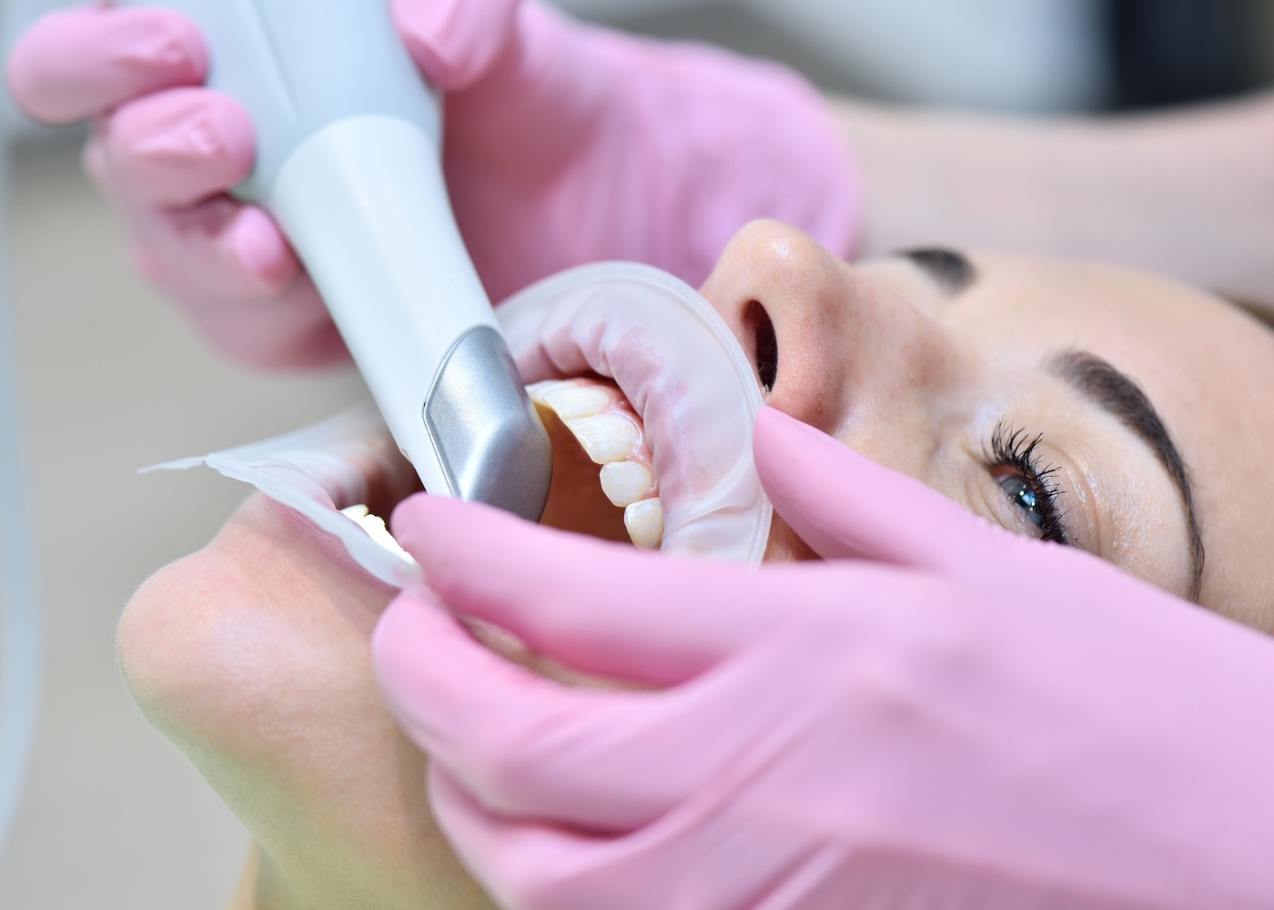 Элайнеры сканирование стоматология Шушары переход на цифровую стоматологию