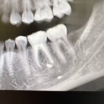 Случай из практики стоматологии в Шушарах